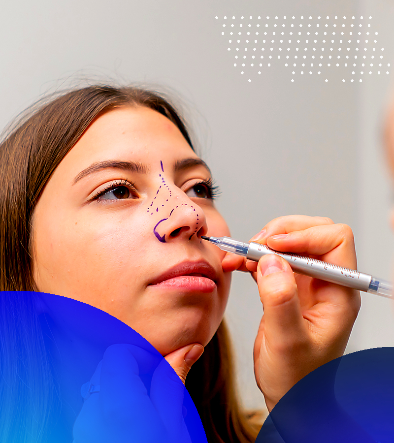Rhinoplasty Consultation Palette A Emulent Emulent