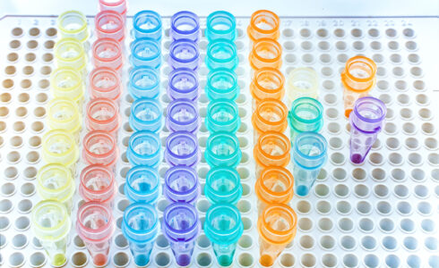 Digital Marketing Strategy For Molecular Genomic Testing Labs To Grow Your Brand scaled