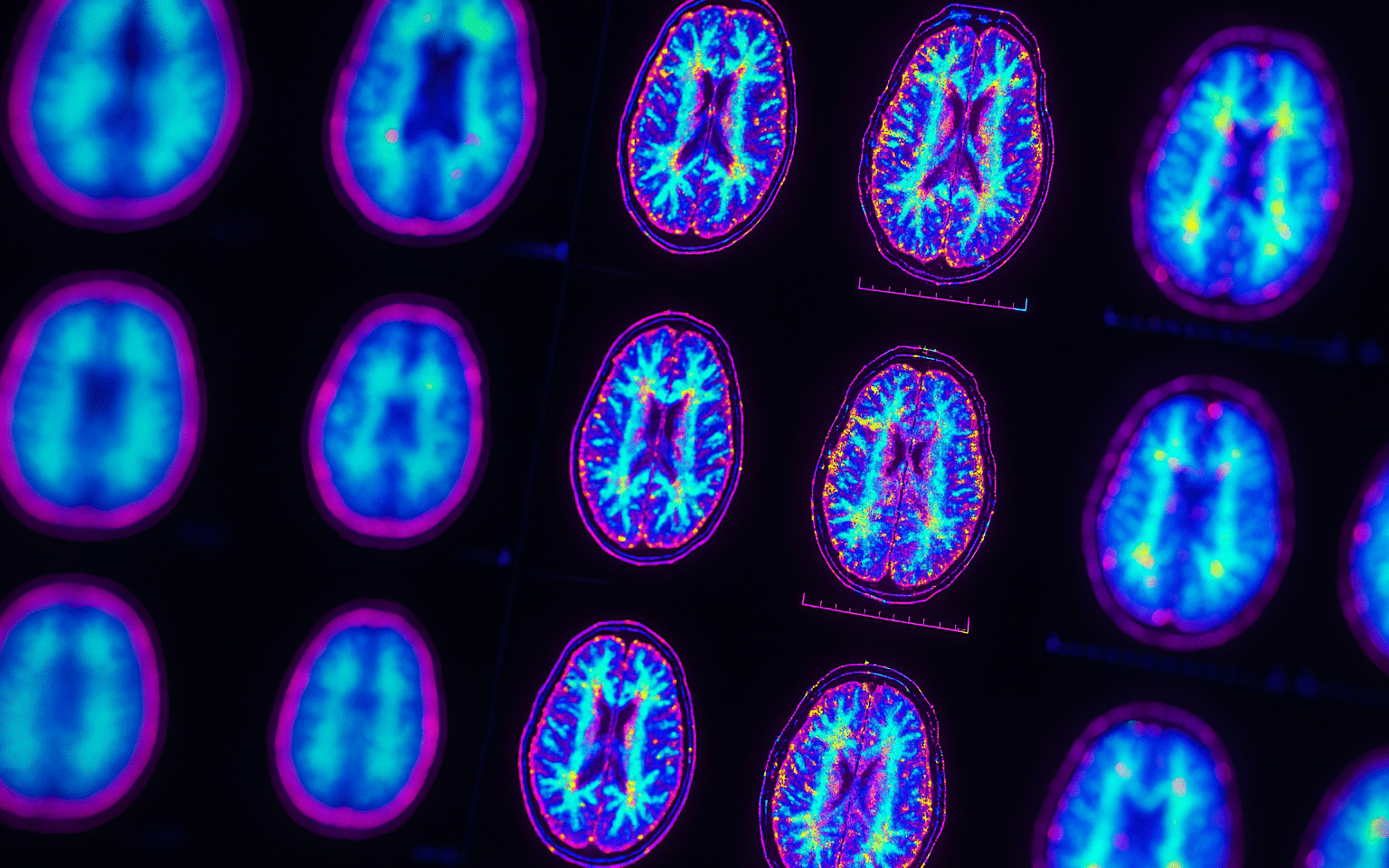 Social Media Strategies For Neurology Practices