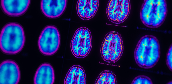 Social Media Strategies For Neurology Practices