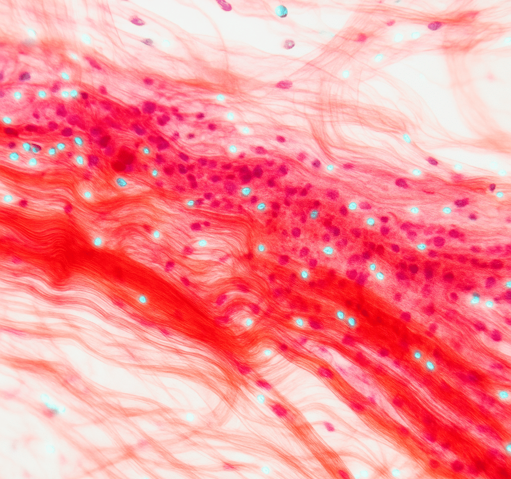 Social Media Strategies For Regenerative Medicine Tissue Engineering Companies