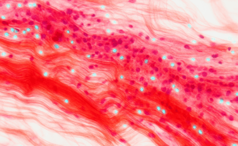 Social Media Strategies For Regenerative Medicine Tissue Engineering Companies